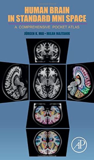Human Brain in Standard MNI Space