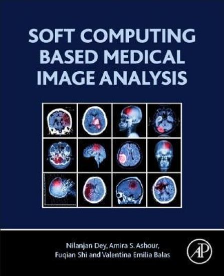 Soft Computing Based Medical Image Analysis – Nilanjan Dey, kirjan kansikuva