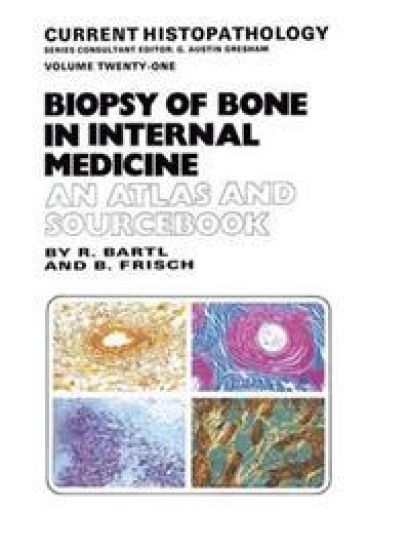 Biopsy of Bone in Internal Medicine