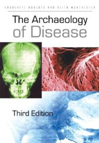The Archaeology of Disease