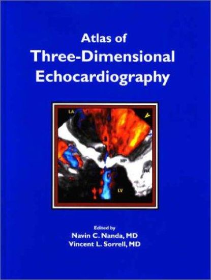 Atlas of Three-Dimensional Echocardiography