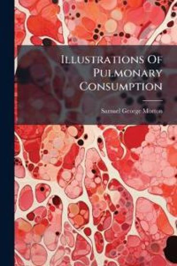 Illustrations Of Pulmonary Consumption