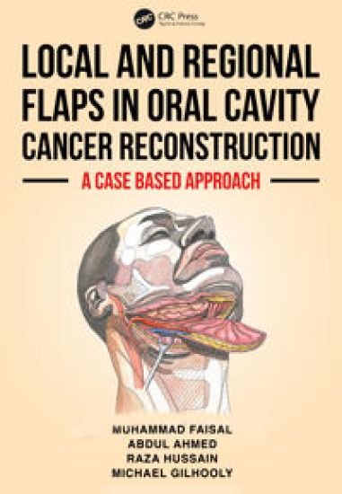 Local and Regional Flaps in Oral Cavity Cancer Reconstruction