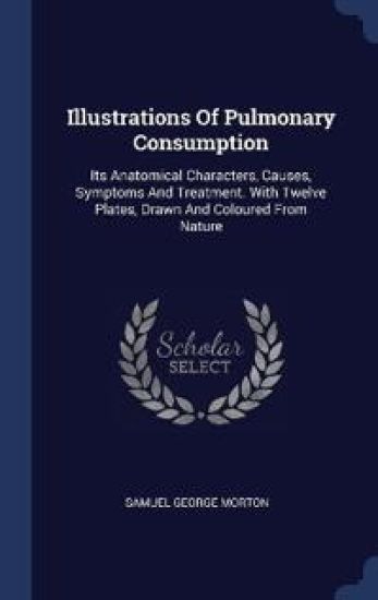 Illustrations Of Pulmonary Consumption