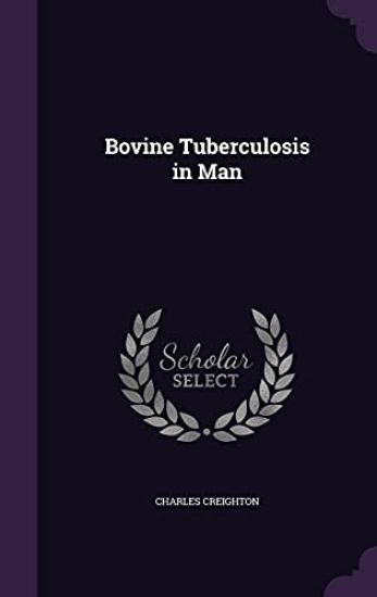 Bovine Tuberculosis in Man