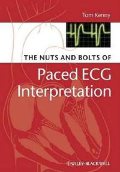 The Nuts and bolts of Paced ECG Interpretation