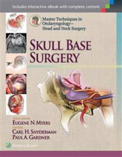 Master Techniques in Otolaryngology - Head and Neck Surgery: Skull Base Surgery – Carl Snyderman, kirjan kansikuva