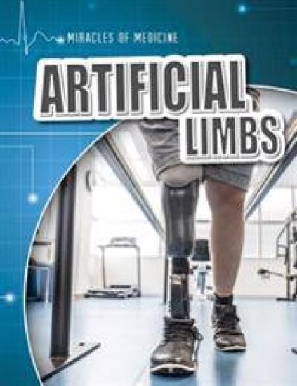 Artificial Limbs