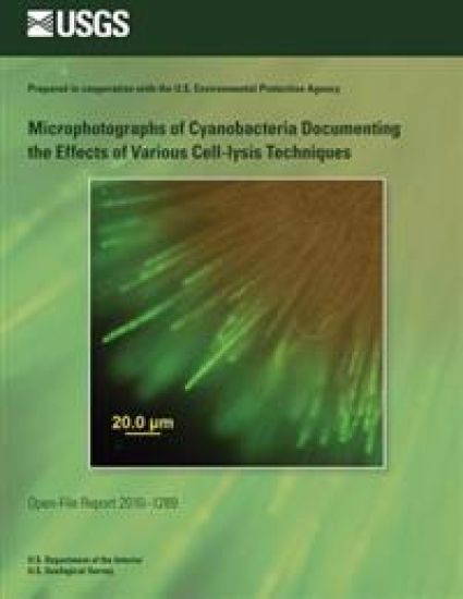 Microphotographs of Cyanobacteria Documenting the Effects of Various Cell-lysis Techniques