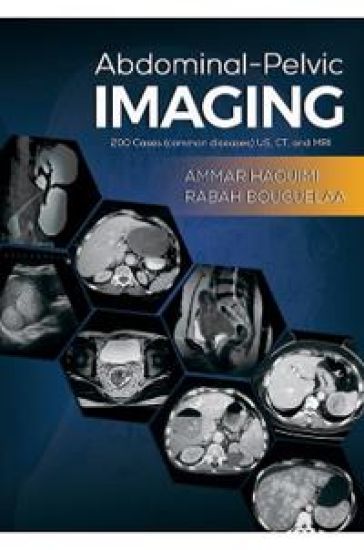Abdominal-Pelvic Imaging