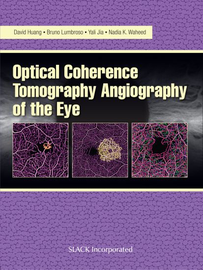Optical Coherence Tomography Angiography of the Eye