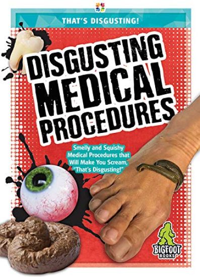 Disgusting Medical Procedures