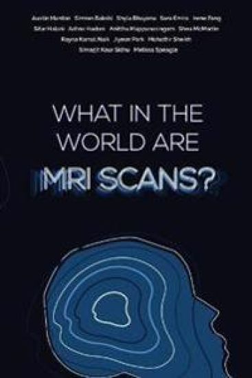 What in the world are MRI Scans?