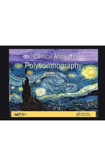 Clinical Atlas of Polysomnography