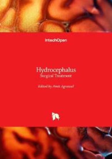 Hydrocephalus