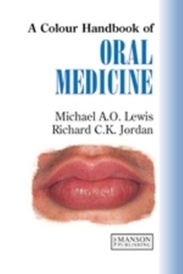 Colour handbook of oral medicine