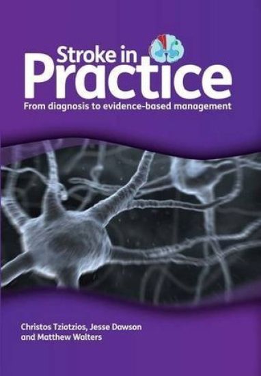 Stroke in Practice