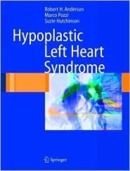 Hypoplastic Left Heart Syndrome