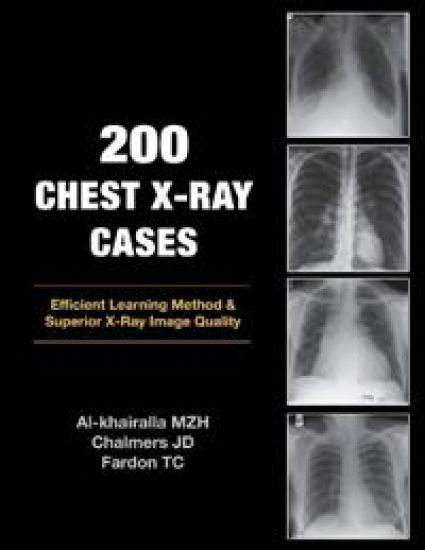 200 Chest X-Ray Cases