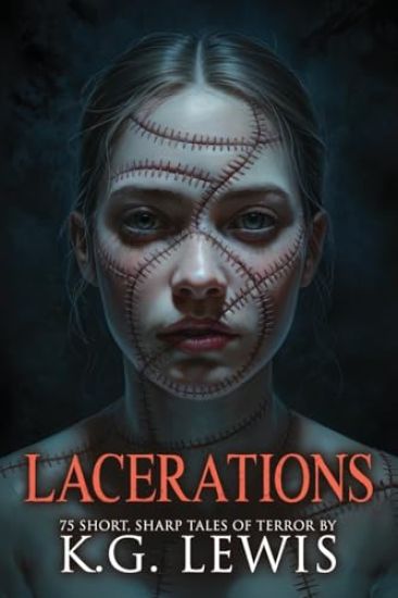Lacerations