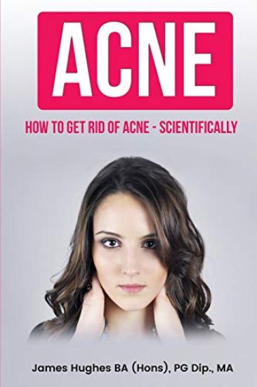 Acne: How to get rid of acne - scientifically
