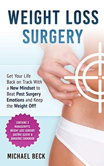 Weight Loss Surgery: Get Your Life Back on Track With a New Mindset to Beat Post Surgery Emotions and Keep the Weight Off! (Contains 3 Manu