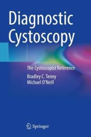 Diagnostic Cystoscopy