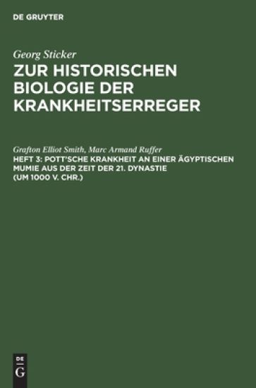Pott'sche Krankheit an Einer Ägyptischen Mumie Aus Der Zeit Der 21. Dynastie (Um 1000 V. Chr.)