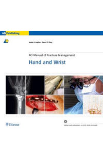AO Manual of Fracture Management - Hand and Wrist