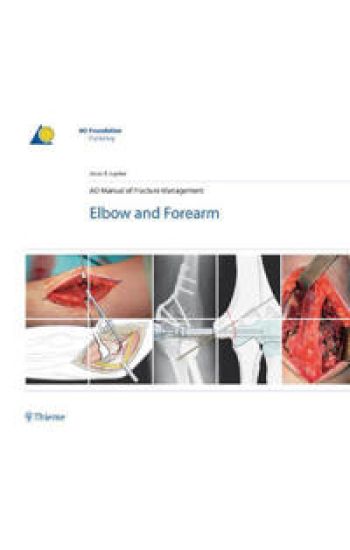 AO Manual of Fracture Management - Elbow & Forearm