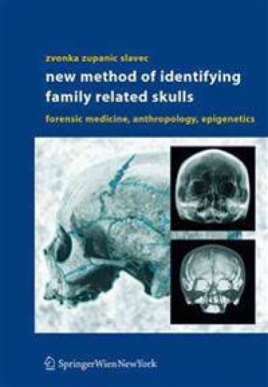New Method of Identifying Family Related Skulls