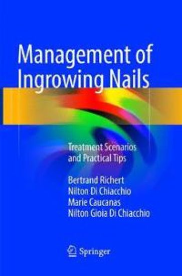 Management of Ingrowing Nails