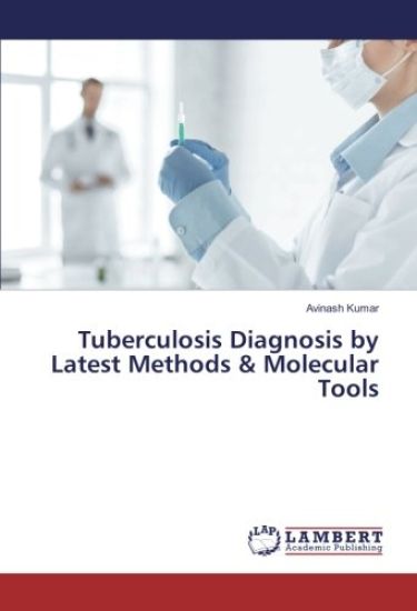 Tuberculosis Diagnosis by Latest Methods & Molecular Tools