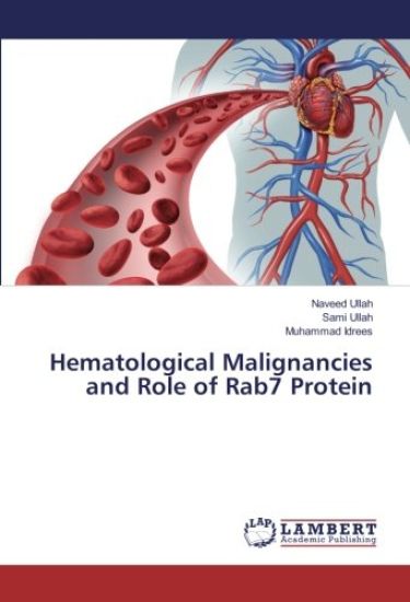 Hematological Malignancies and Role of Rab7 Protein