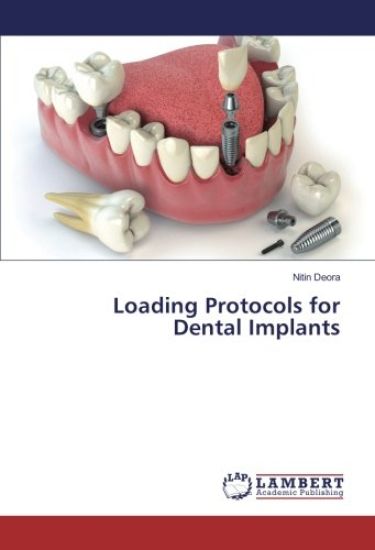 Loading Protocols for Dental Implants