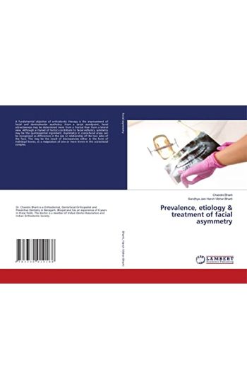 Prevalence, etiology & treatment of facial asymmetry