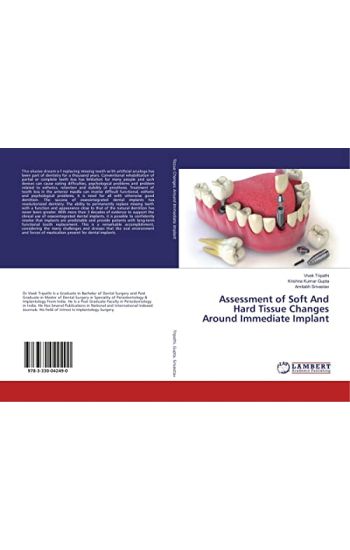 Assessment of Soft And Hard Tissue Changes Around Immediate Implant