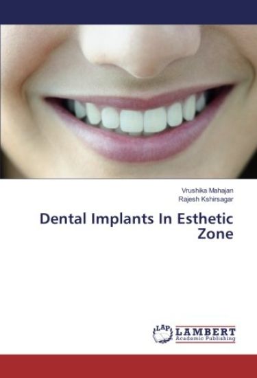 Dental Implants In Esthetic Zone