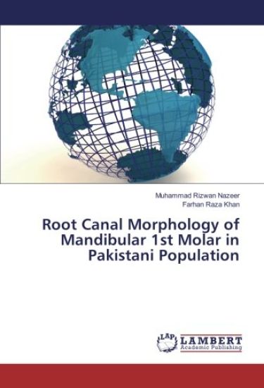 Root Canal Morphology of Mandibular 1st Molar in Pakistani Population