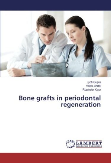 Bone grafts in periodontal regeneration