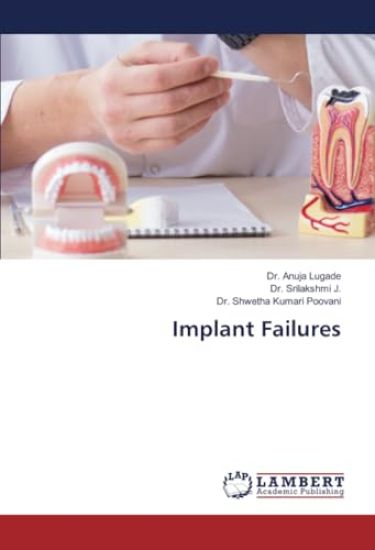 Implant Failures