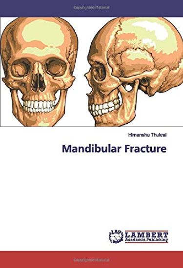 Mandibular Fracture