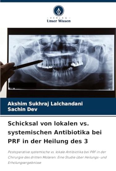 Schicksal von lokalen vs. systemischen Antibiotika bei PRF in der Heilung des 3