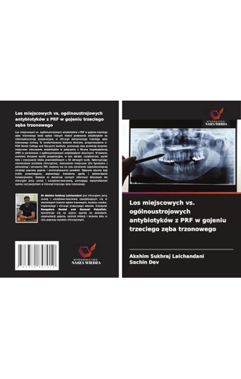 Los miejscowych vs. ogólnoustrojowych antybiotyków z PRF w gojeniu trzeciego z¿ba trzonowego