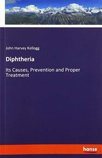 Diphtheria