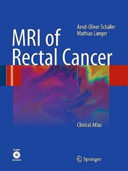MRI of Rectal Cancer