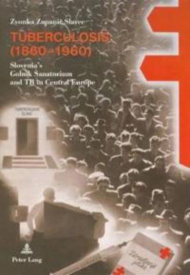 Tuberculosis (1860-1960)