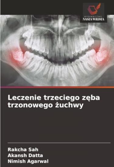 Leczenie trzeciego zeba trzonowego zuchwy