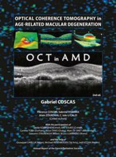 Optical Coherence Tomography in Age-Related Macular Degeneration