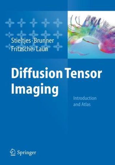 Diffusion Tensor Imaging